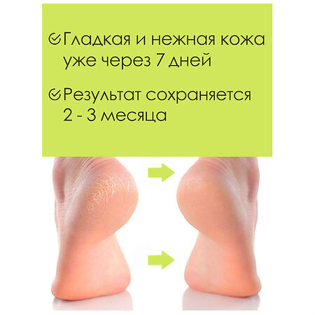 SkinLite Маска-носки для ног отшелушивающая размер 35-40 пара 1 уп