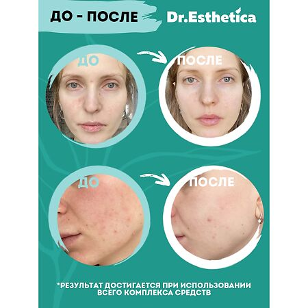 Dr. Esthetica\Др.Эстетика Тоник для лица увлажняющий от прыщей уход за проблемной кожей 200 мл 1 шт