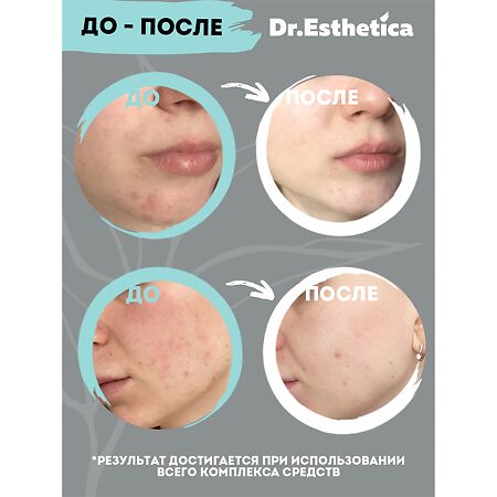 Dr. Esthetica\Др.Эстетика Гель-крем для лица от прыщей уход за проблемной кожей 15 мл 1 шт